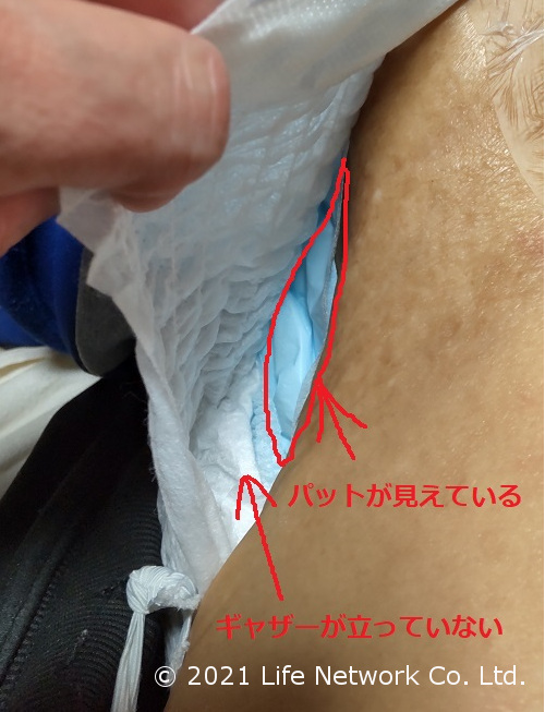 尿取りパットが見えている状態