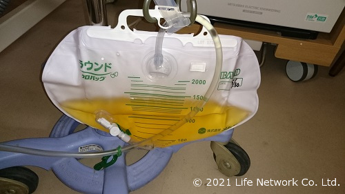 尿道カテーテルを装着
