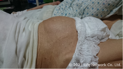 お腹が膨れ上がっている様子