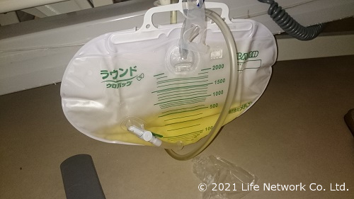 尿閉で尿道カテーテルを装着している様子